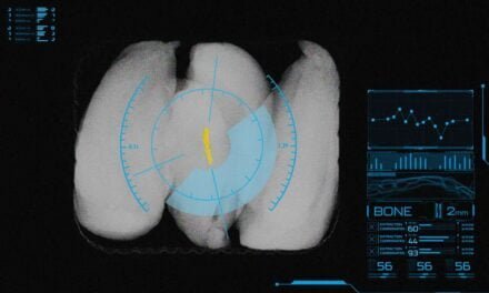 Mettler-Toledo introduces advanced X-ray inspection system