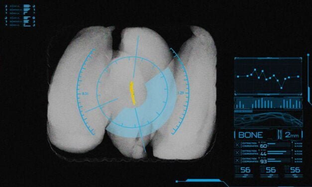 Mettler-Toledo introduces advanced X-ray inspection system